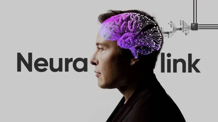 6 个月后，马斯克要将 Neuralink 植入你的大脑