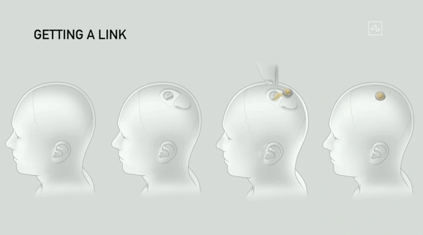 6 个月后，马斯克要将 Neuralink 植入你的大脑
